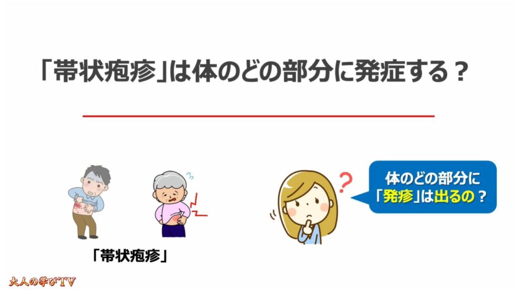 50歳以上で3人に1人が発症（帯状疱疹）：「帯状疱疹」は体のどの部分に発症する？